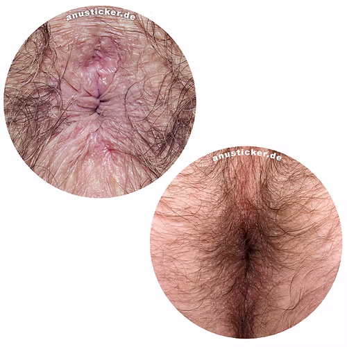 Anusticker Sticker "Very Hairy&quot