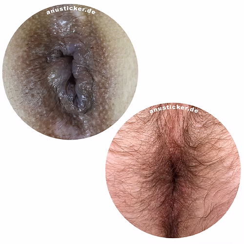 Anusticker Sticker "Mallorca Edition&quot